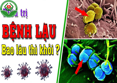 chữa bệnh lậu mất bao lâu