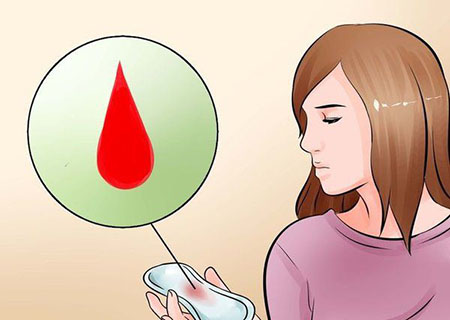 chảy máu âm đạo bất thường
