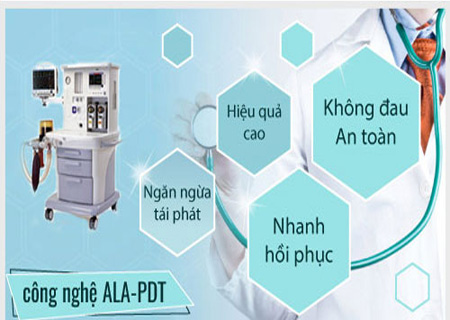 Phương pháp ALA-PDT hỗ trợ điều trị sùi mào gà hiệu quả