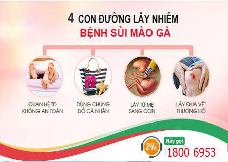 Sùi mào gà lây lan nhanh chóng qua nhiều con đường khác nhau