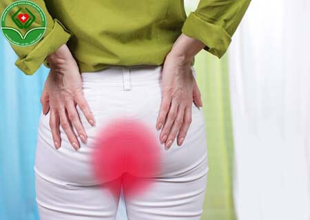 Chữa trĩ cấp độ 4 như thế nào hiệu quả