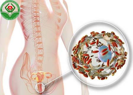 Nấm vùng kín do Gardnerella vaginalis gây ra