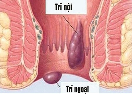 Nhu-the-nao-goi-la-benh-triNhu-the-nao-goi-la-benh-tri