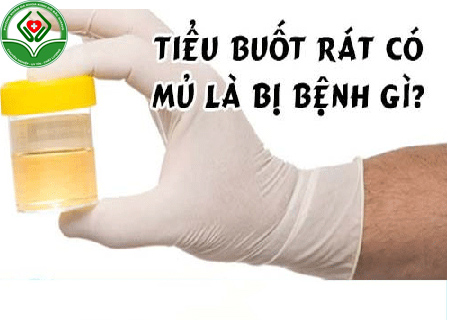 đái buốt và chảy mủ