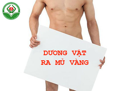 duong-vat-ra-mu-vang