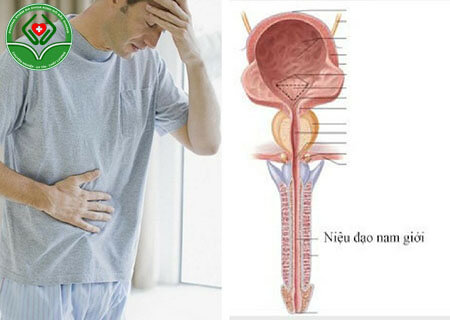 Bệnh viêm niệu đạo do nấm