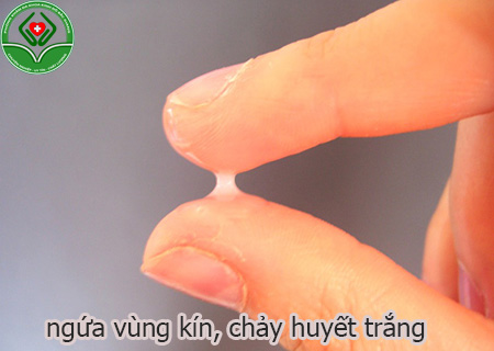 ngứa vùng kín, chảy huyết trắng