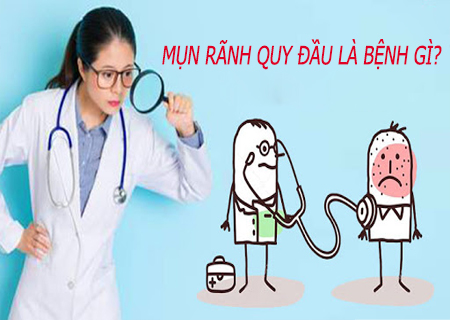 Nổi mụn rãnh quy đầu là dấu hiệu của nhiều bệnh nguy hiểm